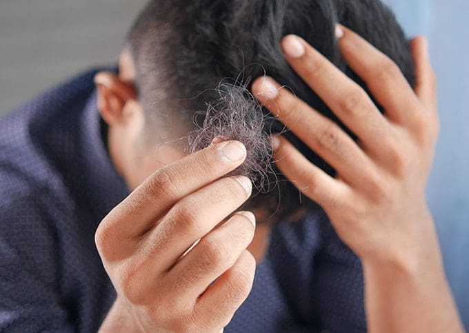 Hair loss treatment methods